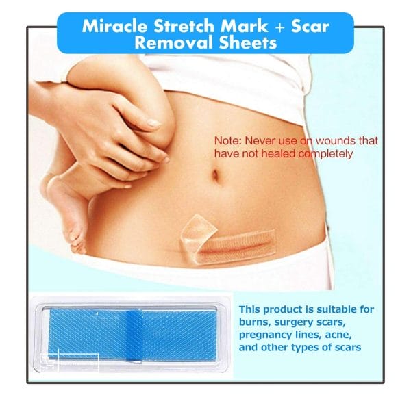 MIRACLE STRETCH MARK + SCAR REMOVAL SHEETS