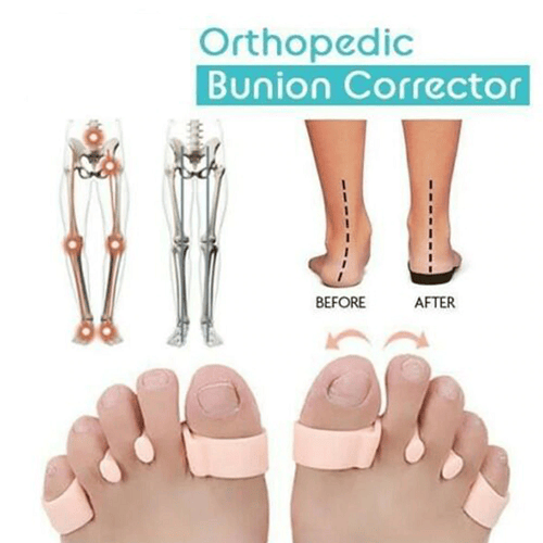 Orthopedic Bunion Corrector